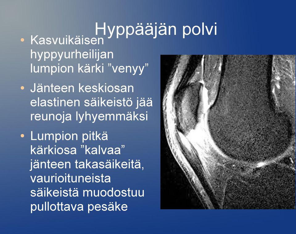 reunoja lyhyemmäksi Lumpion pitkä kärkiosa kalvaa jänteen