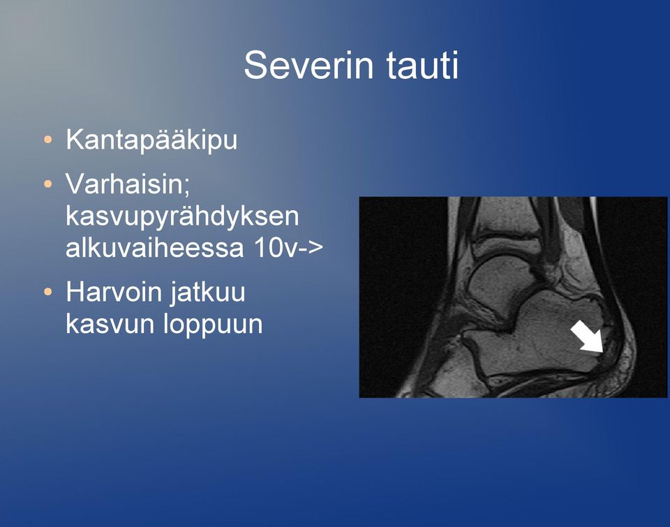 kasvupyrähdyksen