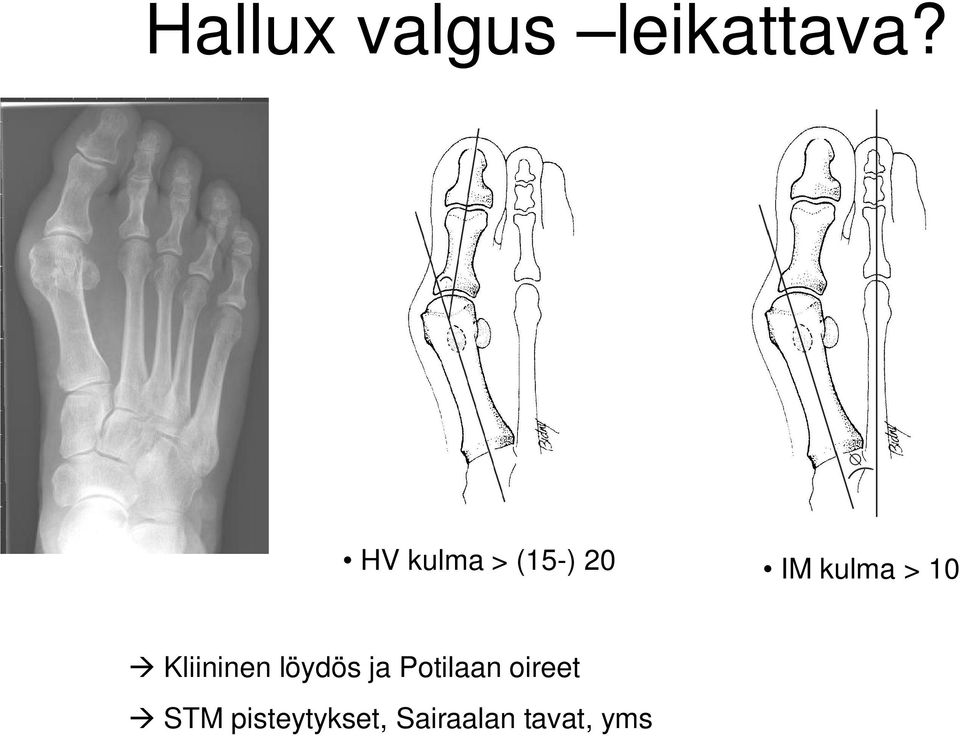 Kliininen löydös ja Potilaan