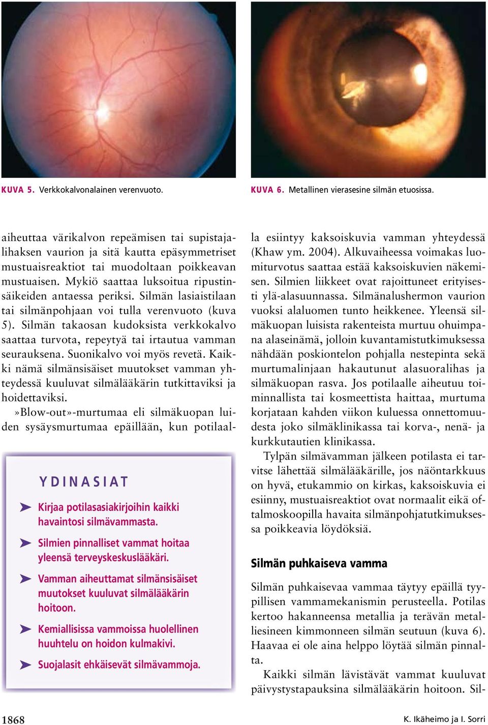 Mykiö saattaa luksoitua ripustinsäikeiden antaessa periksi. Silmän lasiaistilaan tai silmänpohjaan voi tulla verenvuoto (kuva 5).