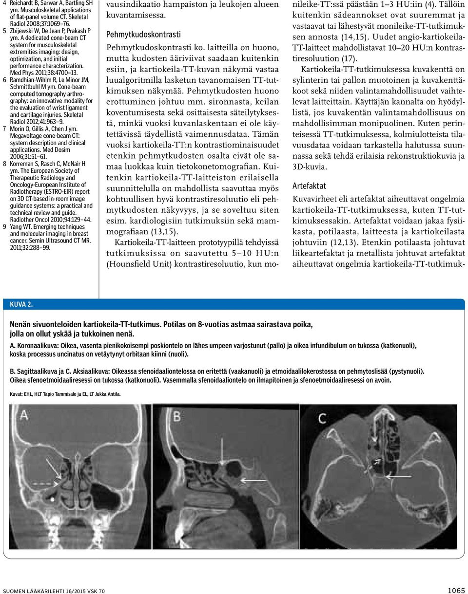 6 Ramdhian-Wihlm R, Le Minor JM, Schmittbuhl M ym. Cone-beam computed tomography arthrography: an innovative modality for the evaluation of wrist ligament and cartilage injuries.