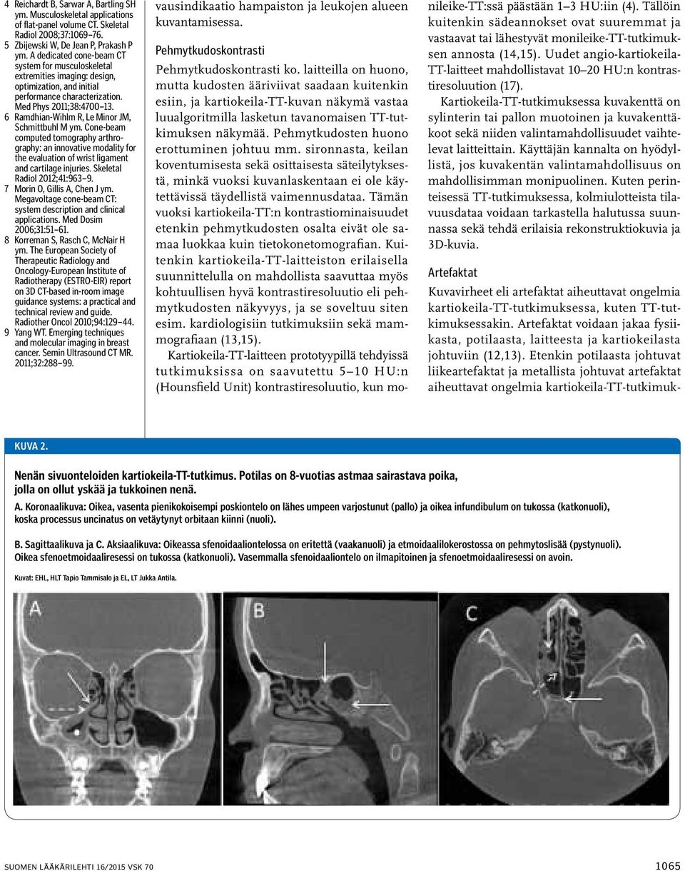 6 Ramdhian-Wihlm R, Le Minor JM, Schmittbuhl M ym. Cone-beam computed tomography arthrography: an innovative modality for the evaluation of wrist ligament and cartilage injuries.