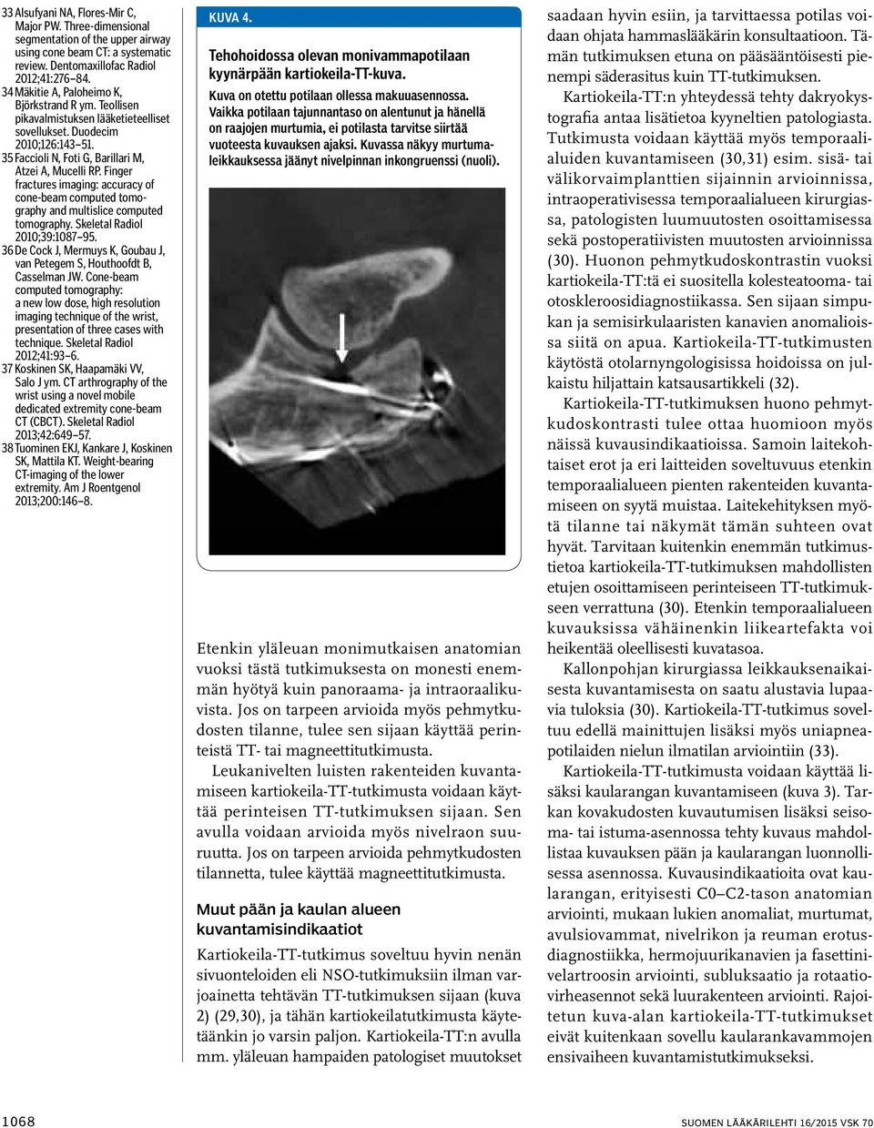 Finger fractures imaging: accuracy of cone-beam computed tomography and multislice computed tomography. Skeletal Radiol 2010;39:1087 95.