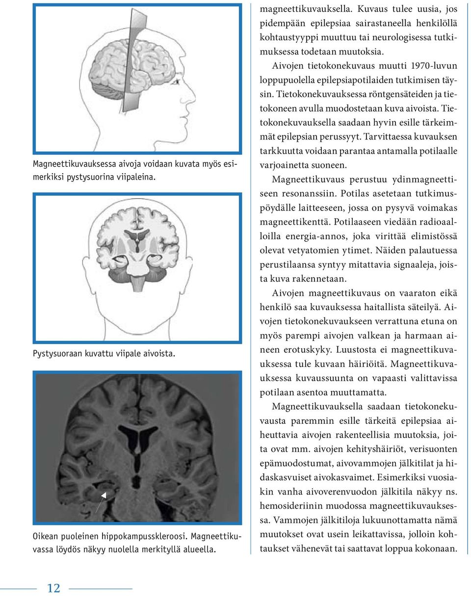 Kuvaus tulee uusia, jos pidempään epilepsiaa sairastaneella henkilöllä kohtaustyyppi muuttuu tai neurologisessa tutkimuksessa todetaan muutoksia.