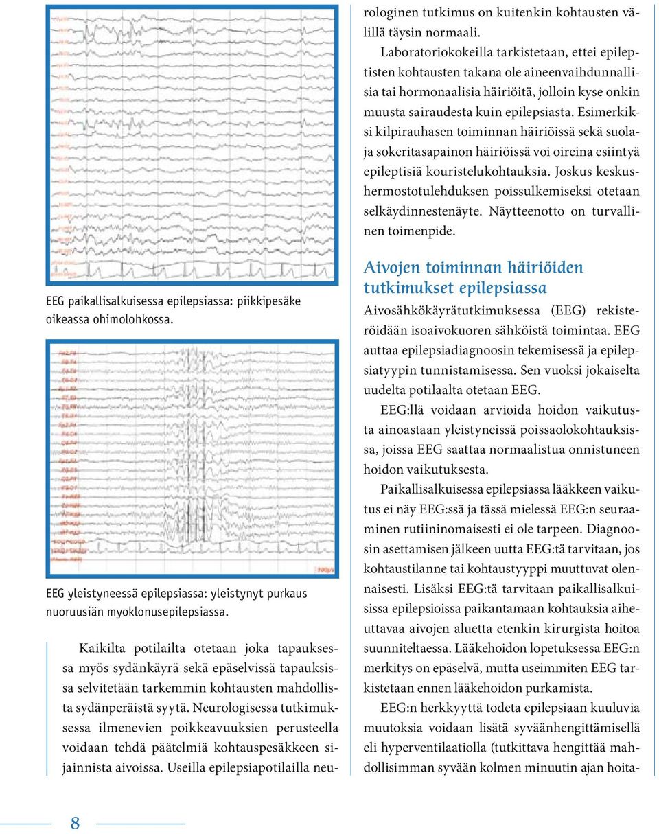 Useilla epilepsiapotilailla neurologinen tutkimus on kuitenkin kohtausten välillä täysin normaali.