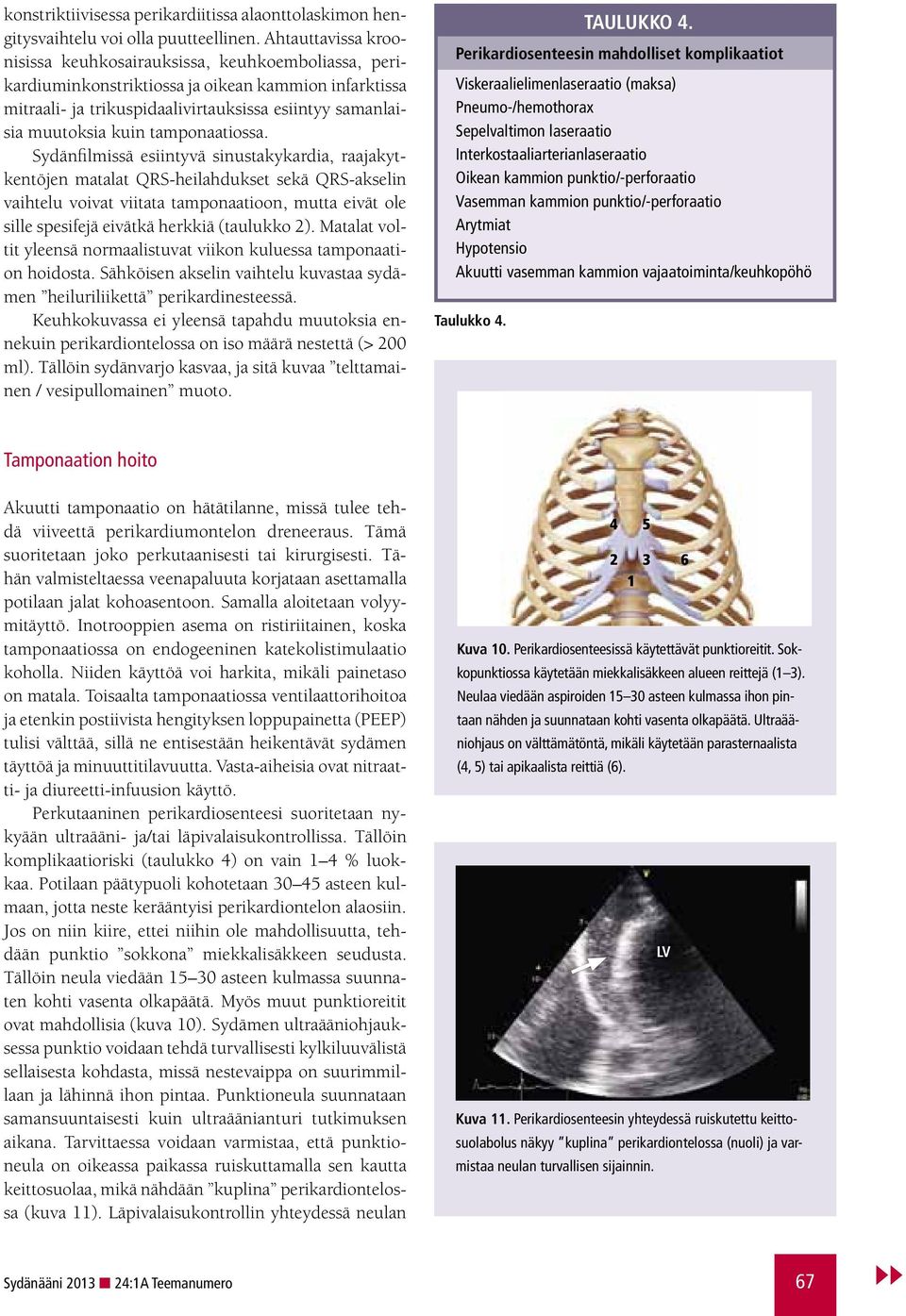 tamponaatiossa.