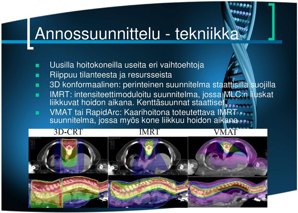 intensiteettimoduloitu suunnitelma, jossa MLC:n liuskat liikkuvat hoidon aikana.