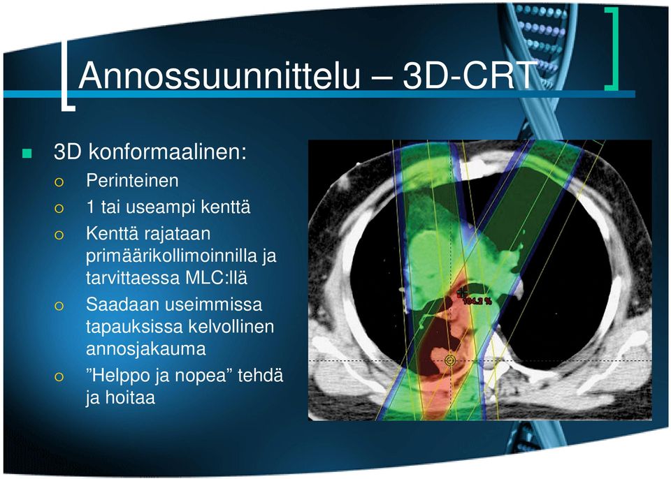 primäärikollimoinnilla ja tarvittaessa MLC:llä Saadaan