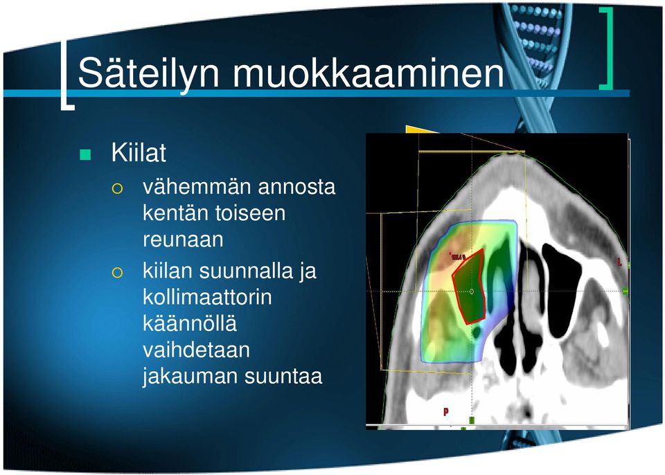 reunaan kiilan suunnalla ja