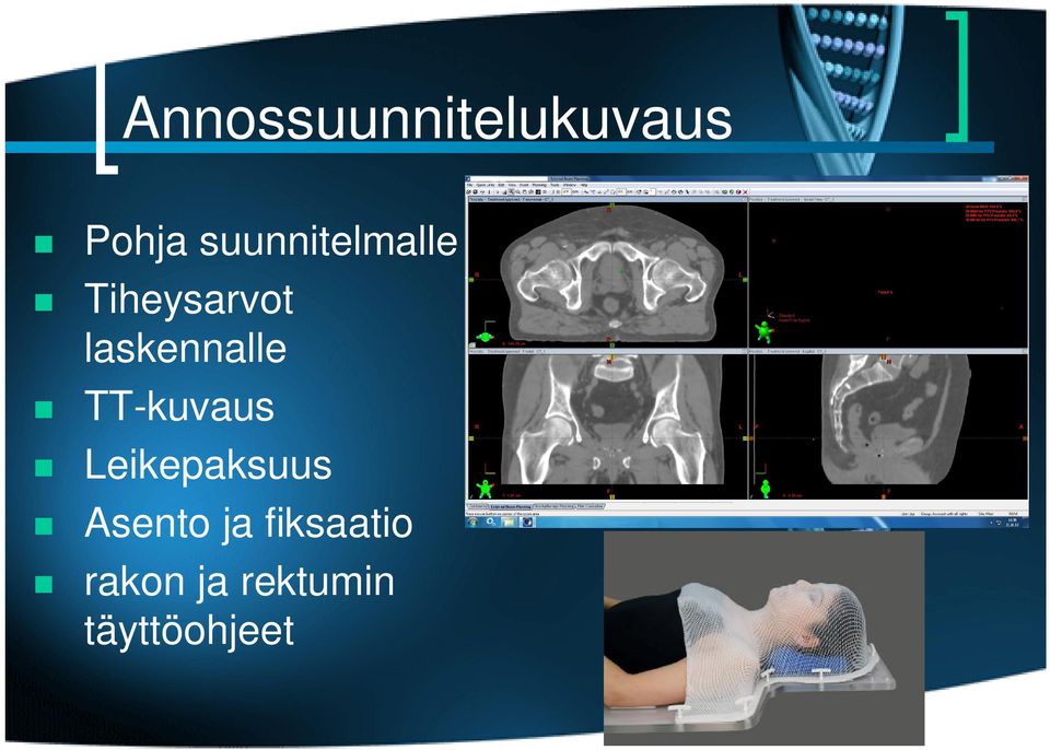 laskennalle TT-kuvaus Leikepaksuus