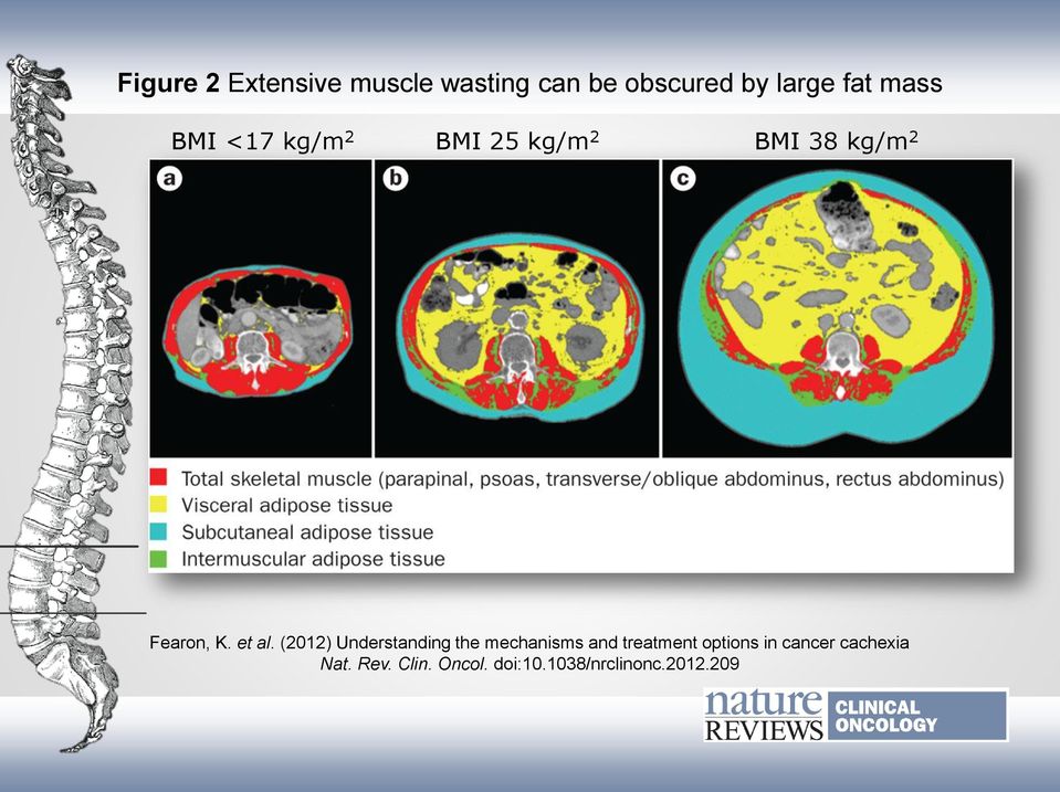 (2012) Understanding the mechanisms and treatment options in