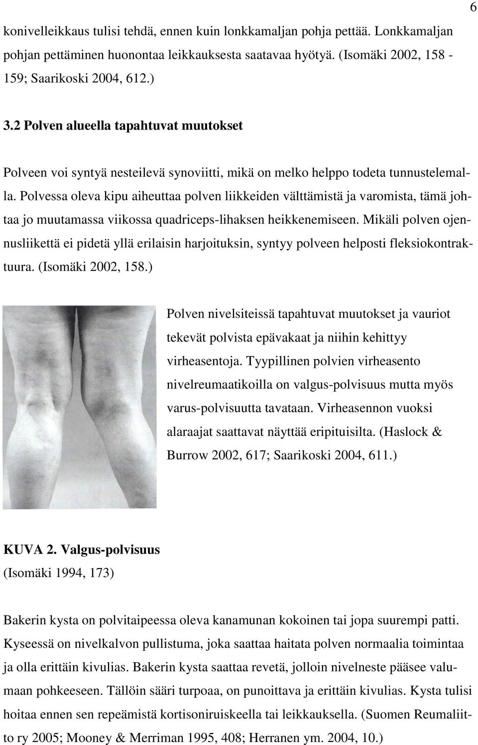 Polvessa oleva kipu aiheuttaa polven liikkeiden välttämistä ja varomista, tämä johtaa jo muutamassa viikossa quadriceps-lihaksen heikkenemiseen.