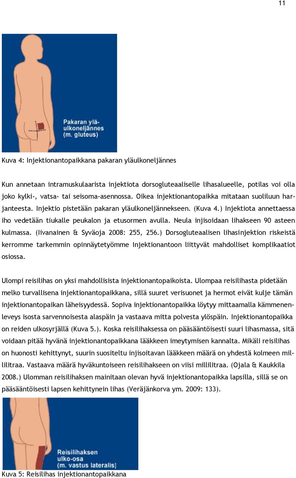 Neula injisoidaan lihakseen 90 asteen kulmassa. (Iivanainen & Syväoja 2008: 255, 256.