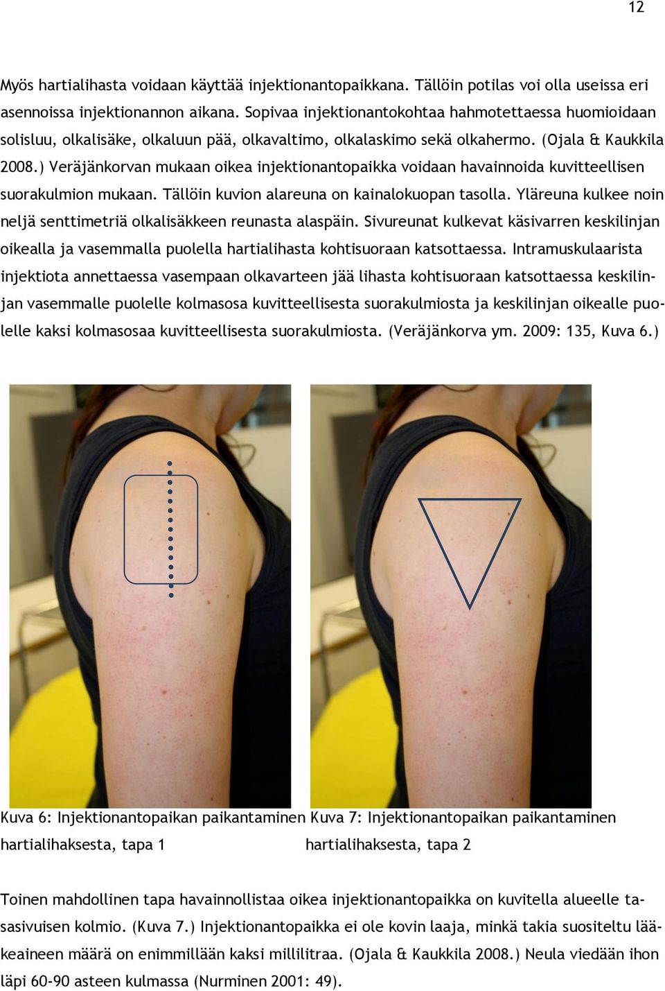 ) Veräjänkorvan mukaan oikea injektionantopaikka voidaan havainnoida kuvitteellisen suorakulmion mukaan. Tällöin kuvion alareuna on kainalokuopan tasolla.