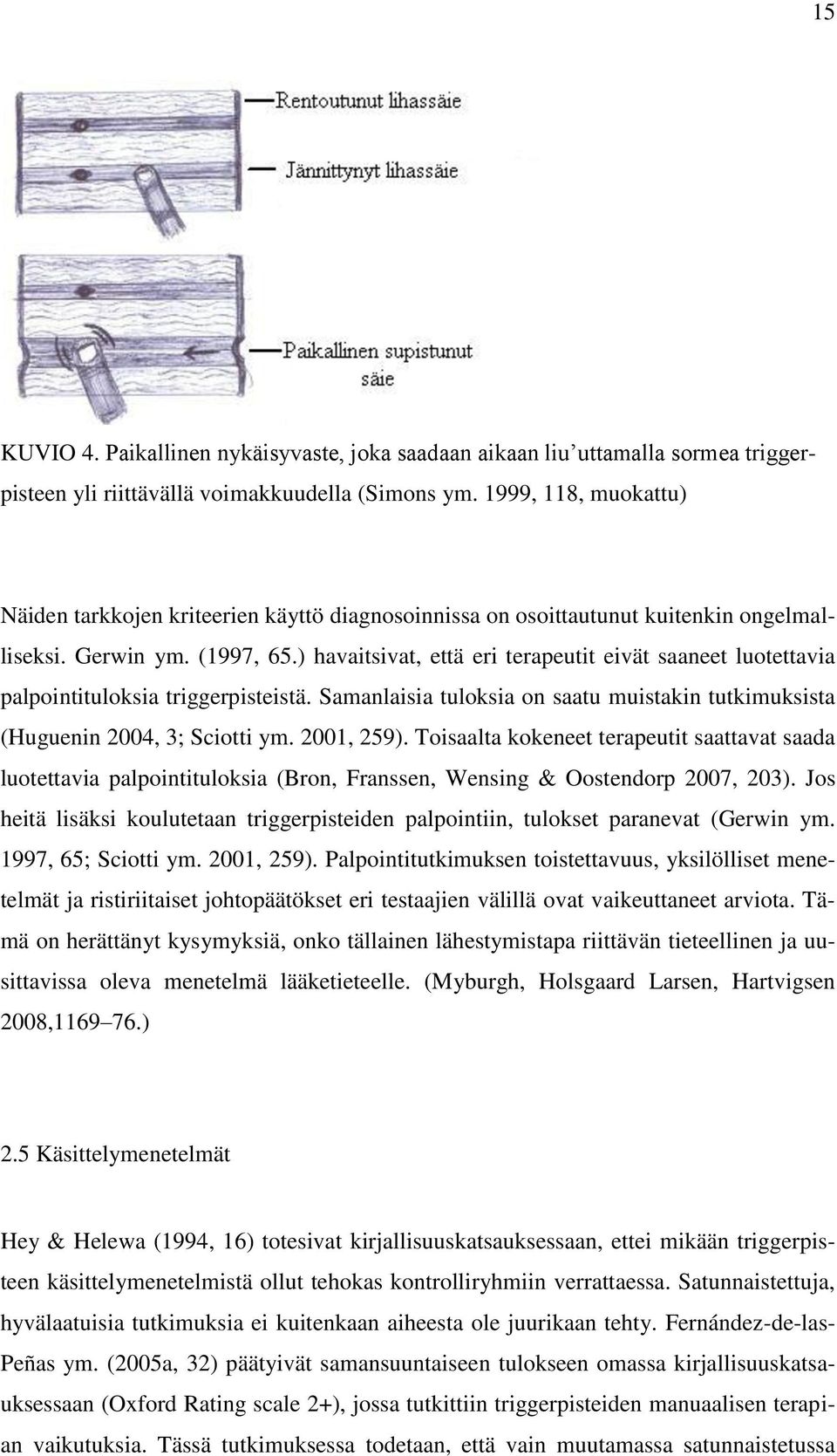 ) havaitsivat, että eri terapeutit eivät saaneet luotettavia palpointituloksia triggerpisteistä. Samanlaisia tuloksia on saatu muistakin tutkimuksista (Huguenin 2004, 3; Sciotti ym. 2001, 259).