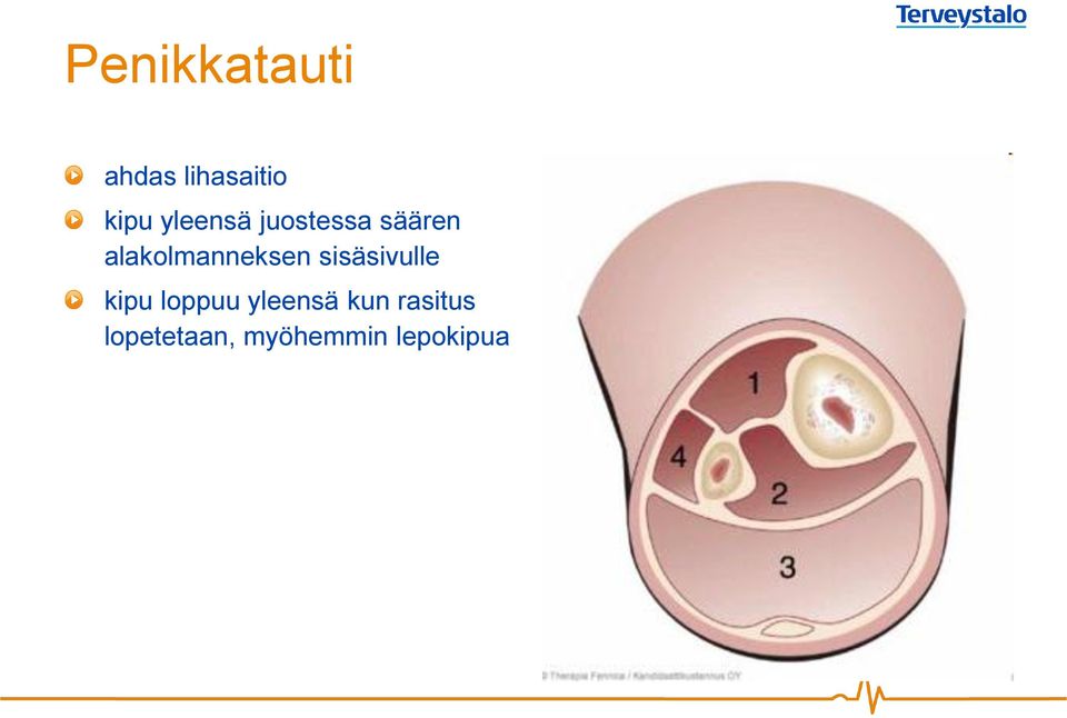 alakolmanneksen sisäsivulle kipu