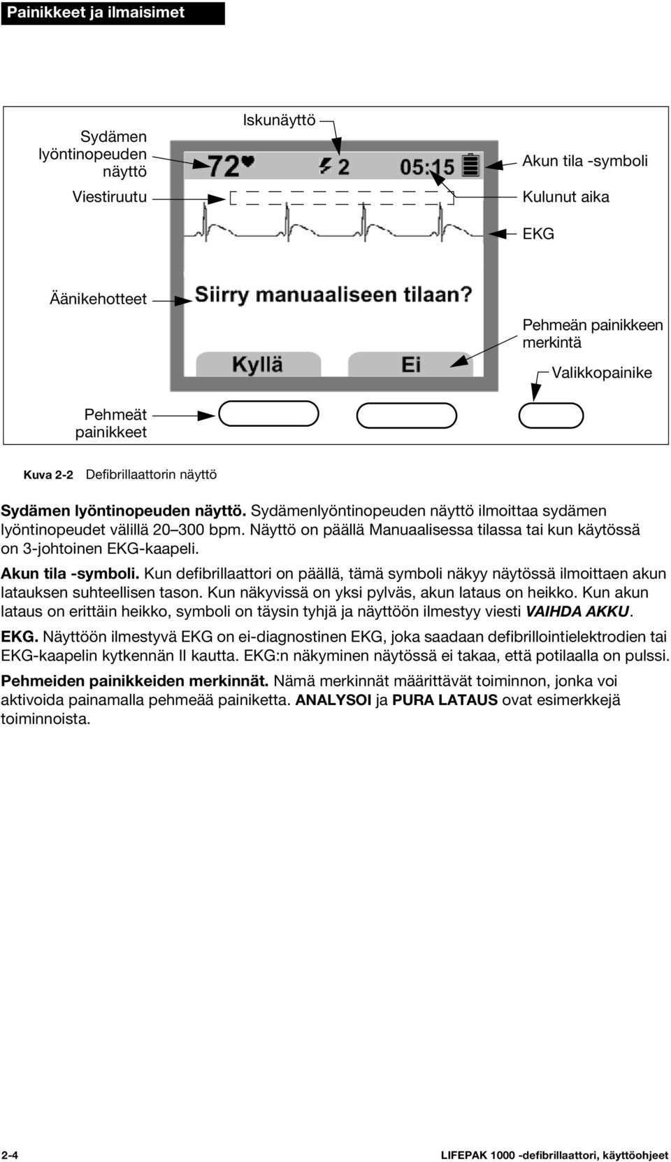 Näyttö on päällä Manuaalisessa tilassa tai kun käytössä on 3-johtoinen EKG-kaapeli. Akun tila -symboli.