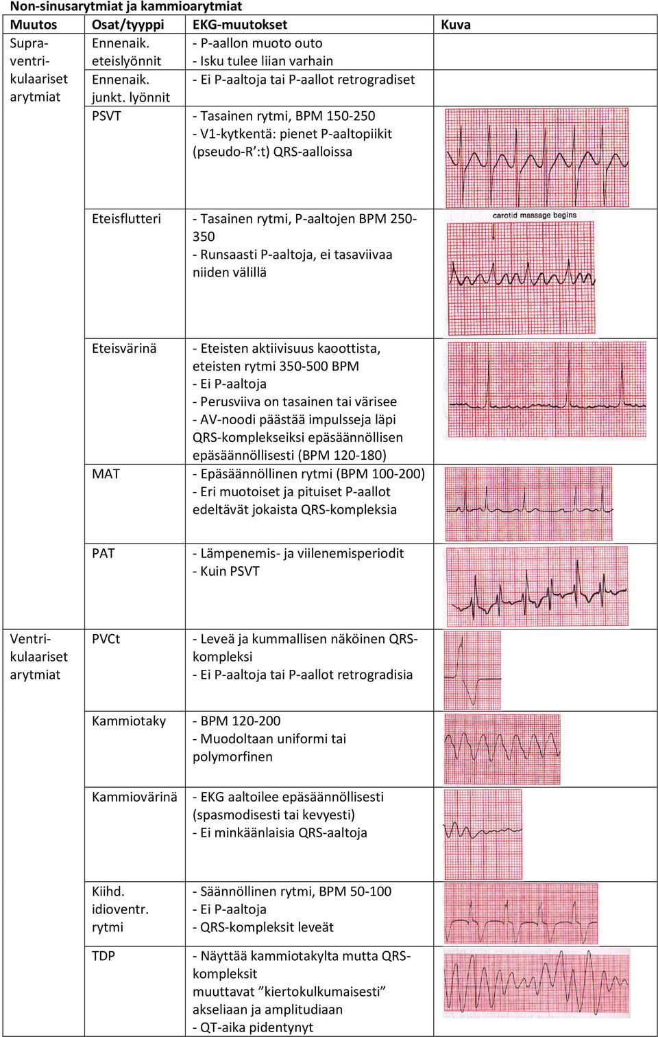 lyönnit PSVT - Tasainen rytmi, BPM 150-250 - V1-kytkentä: pienet P-aaltopiikit (pseudo-r :t) QRS-aalloissa Eteisflutteri - Tasainen rytmi, P-aaltojen BPM 250-350 - Runsaasti P-aaltoja, ei tasaviivaa