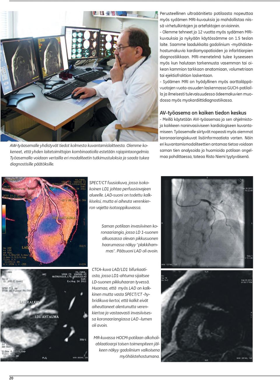 Saamme laadukkaita gadolinium -myöhäistehostumakuvia kardiomyopatioiden ja infarktiarpien diagnostiikkaan.