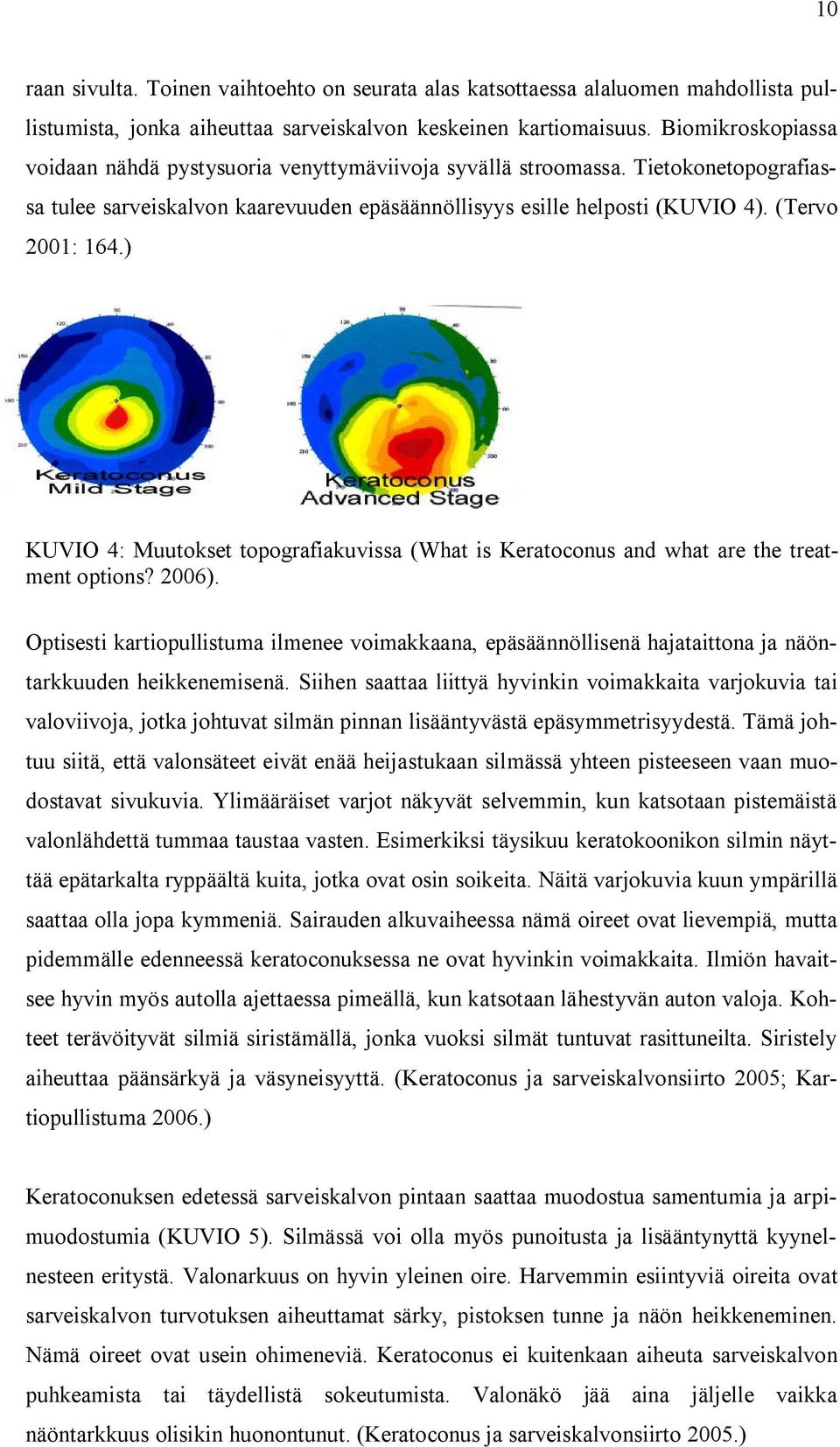 ) KUVIO 4: Muutokset topografiakuvissa (What is Keratoconus and what are the treatment options? 2006).