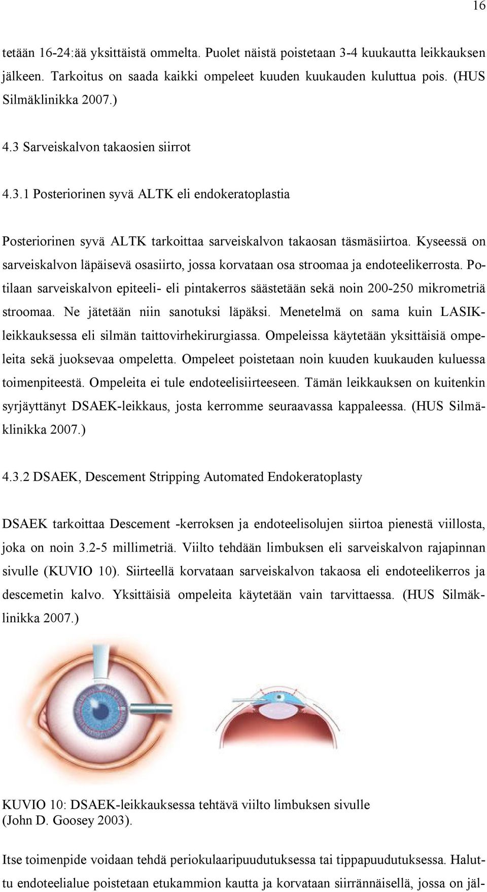 Kyseessä on sarveiskalvon läpäisevä osasiirto, jossa korvataan osa stroomaa ja endoteelikerrosta. Potilaan sarveiskalvon epiteeli- eli pintakerros säästetään sekä noin 200-250 mikrometriä stroomaa.