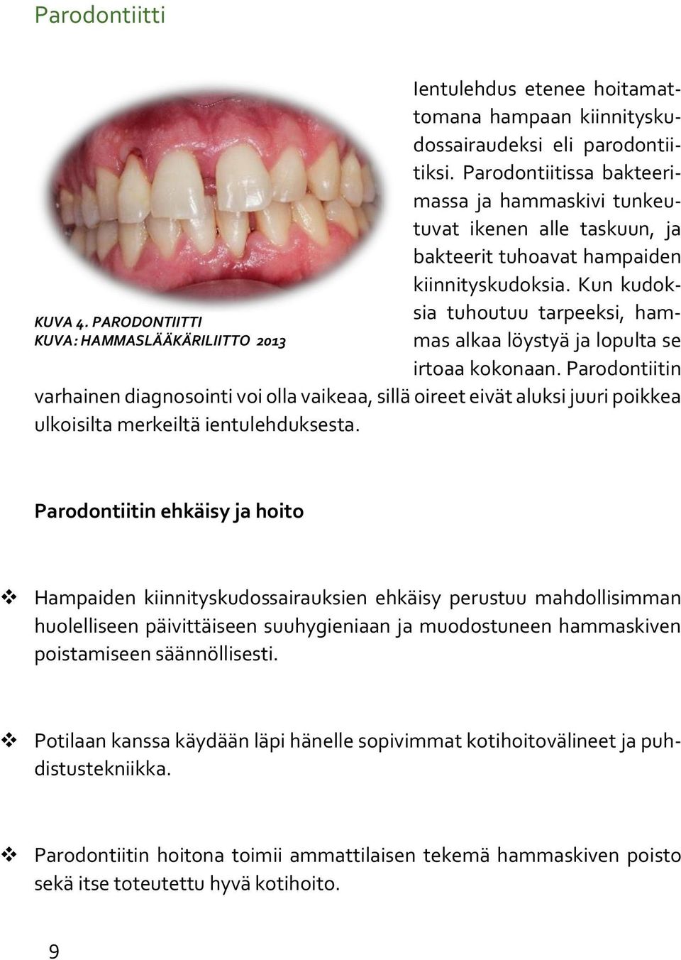 Kun kudoksia tuhoutuu tarpeeksi, hammas alkaa löystyä ja lopulta se irtoaa kokonaan.