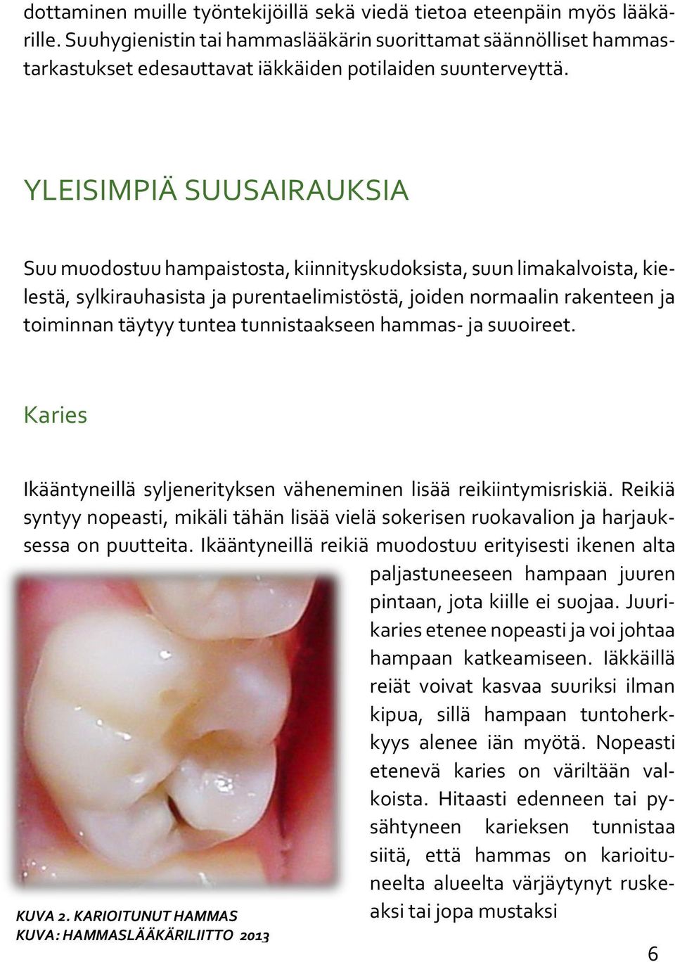 YLEISIMPIÄ SUUSAIRAUKSIA Suu muodostuu hampaistosta, kiinnityskudoksista, suun limakalvoista, kielestä, sylkirauhasista ja purentaelimistöstä, joiden normaalin rakenteen ja toiminnan täytyy tuntea