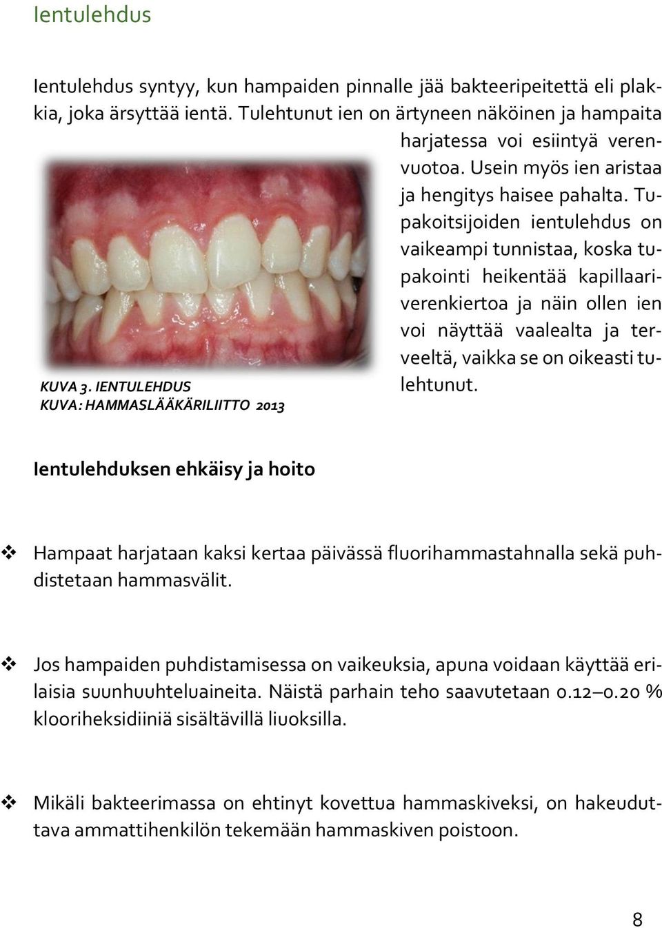 Tupakoitsijoiden ientulehdus on vaikeampi tunnistaa, koska tupakointi heikentää kapillaariverenkiertoa ja näin ollen ien voi näyttää vaalealta ja terveeltä, vaikka se on oikeasti tulehtunut. KUVA 3.