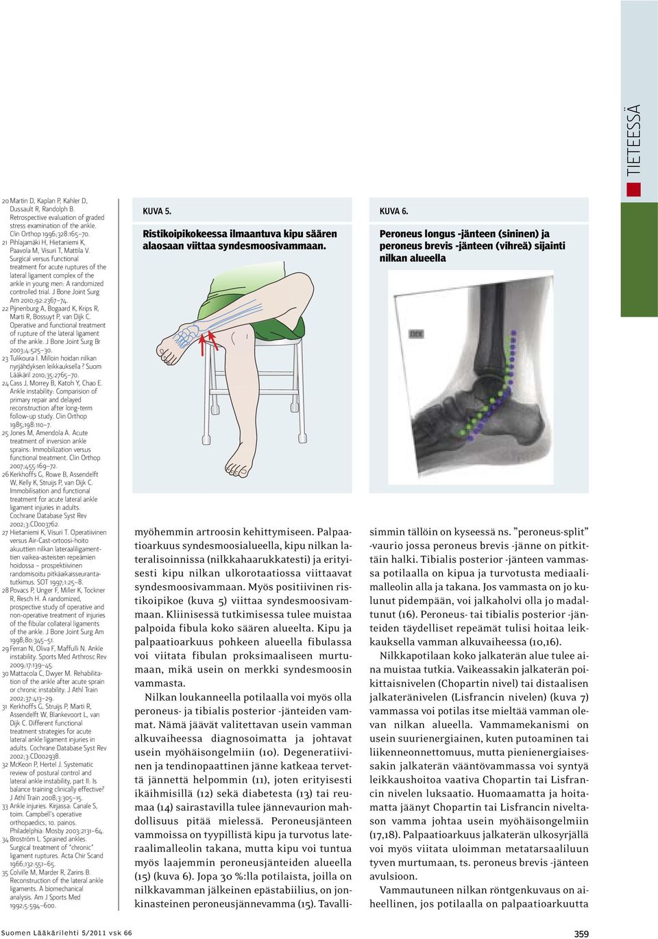 Surgical versus functional treatment for acute ruptures of the lateral ligament complex of the ankle in young men: A randomized controlled trial. J Bone Joint Surg Am 2010;92:2367 74.