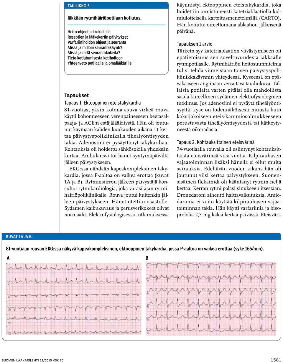 Ektooppinen eteistakykardia 81-vuotias, yksin kotona asuva virkeä rouva käytti kohonneeseen verenpaineeseen beetasalpaaja- ja ACE:n estäjälääkitystä.