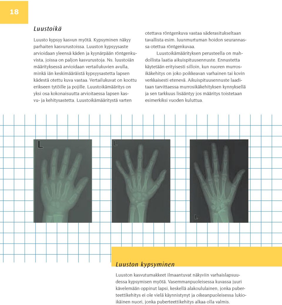 Luustoikämääritys on yksi osa kokonaisuutta arvioitaessa lapsen kasvu- ja kehitysastetta. Luustoikämääritystä varten otettava röntgenkuva vastaa säderasitukseltaan tavallista esim.