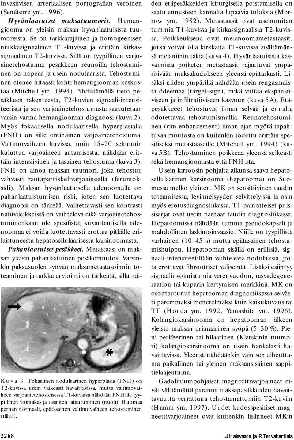 latautuminen (nuoli). Huomaa pernan normaali, epätasainen valtimovaiheen tehostuminen (tähti). invasiivisen arteriaalisen portografian veroinen (Senéterre ym. 1996). Hyvänlaatuiset maksatuumorit.