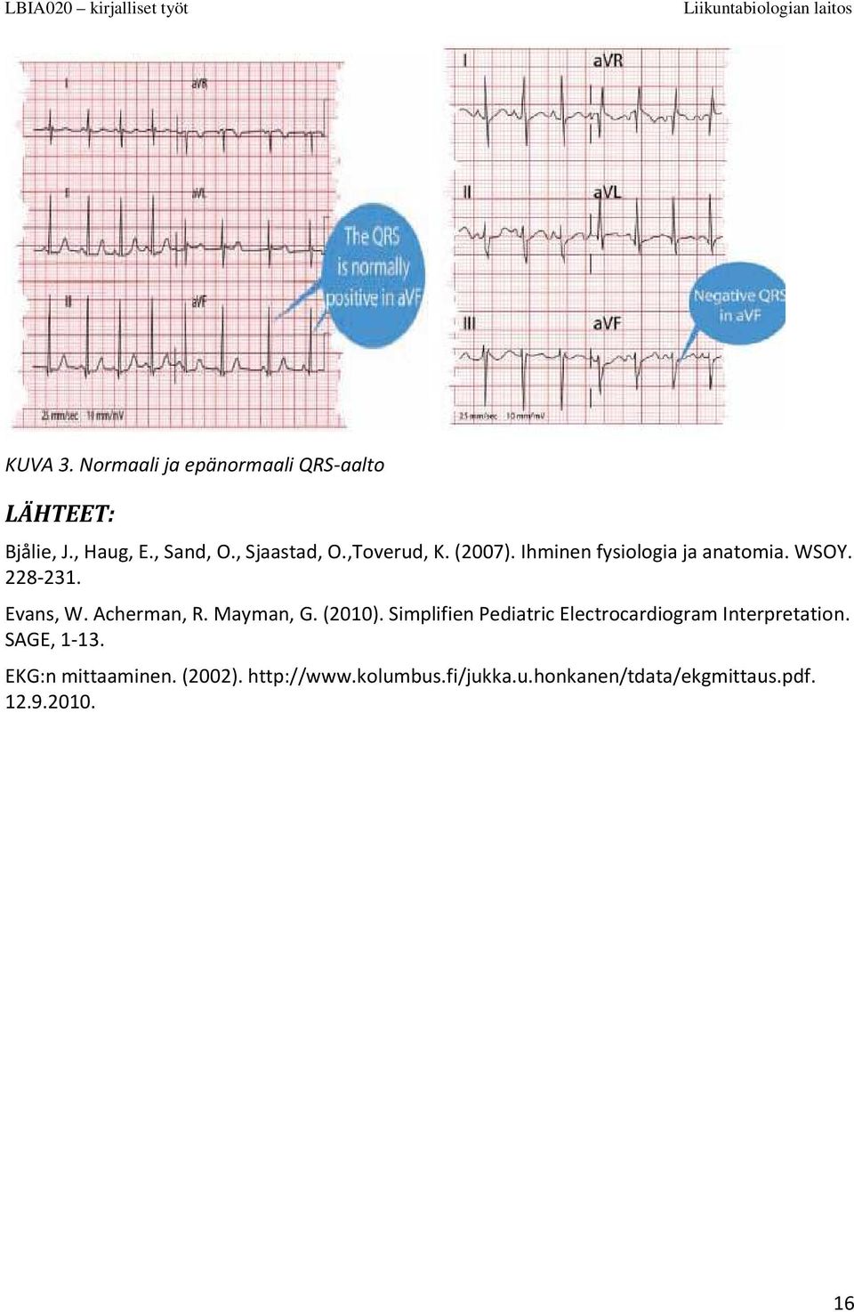 Acherman, R. Mayman, G. (2010). Simplifien Pediatric Electrocardiogram Interpretation.