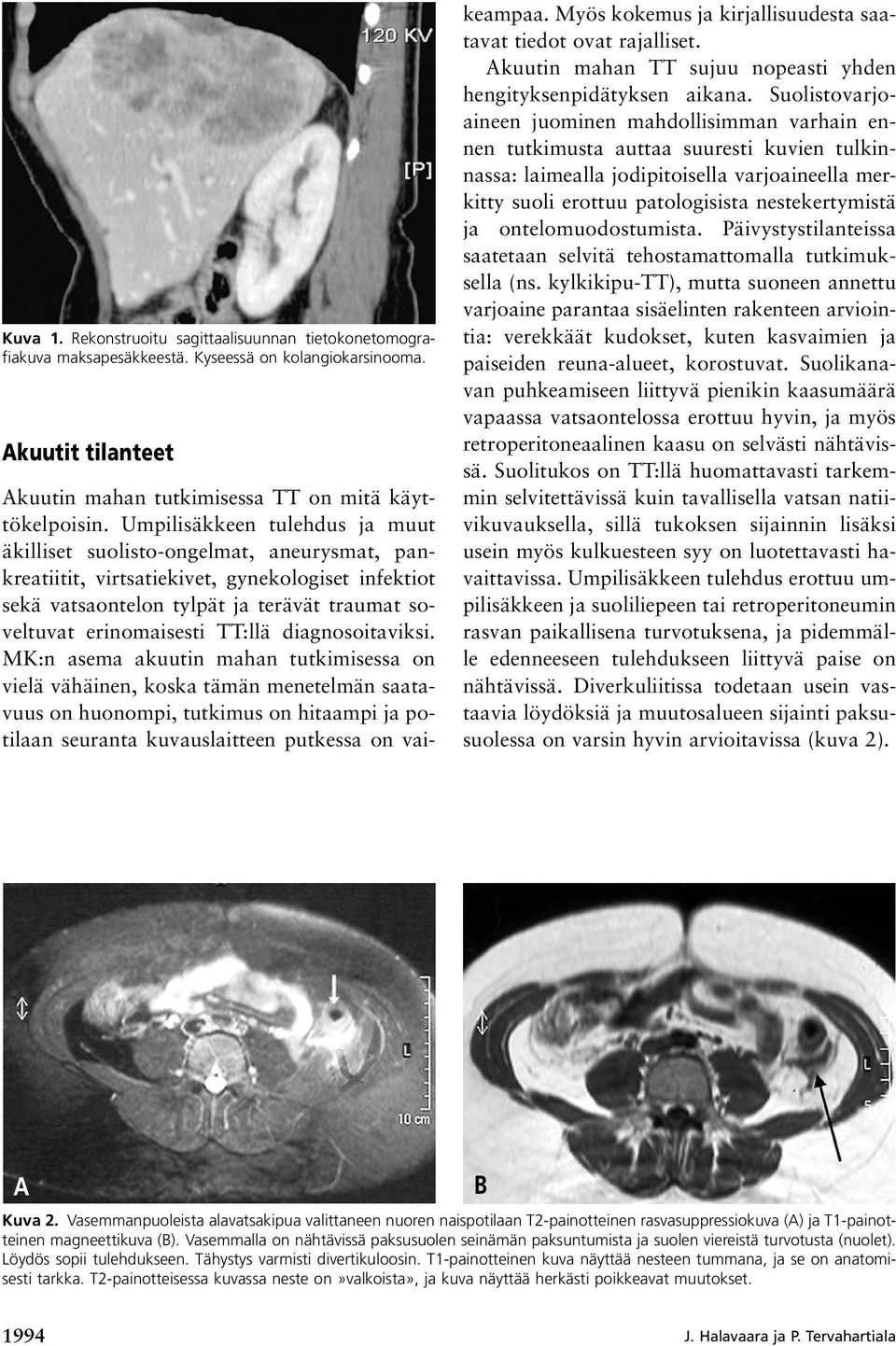 TT:llä diagnosoitaviksi.