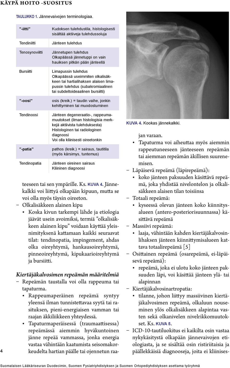 pitkän pään jänteellä Limapussin tulehdus Olkapäässä useimmiten olkalisäkkeen tai hartialihaksen alaisen limapussin tulehdus (subakromiaalinen tai subdeltoideaalinen bursiitti) osis (kreik.