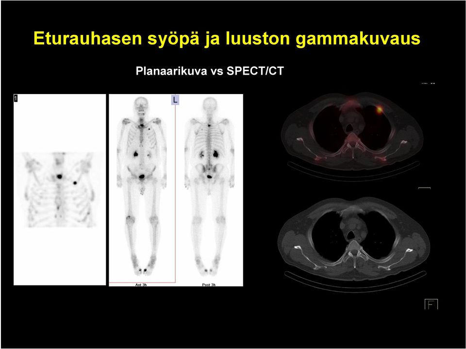 gammakuvaus