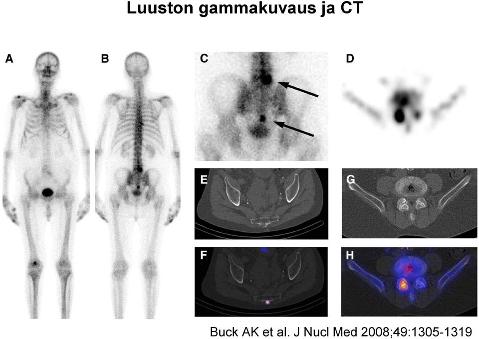 Buck AK et al.