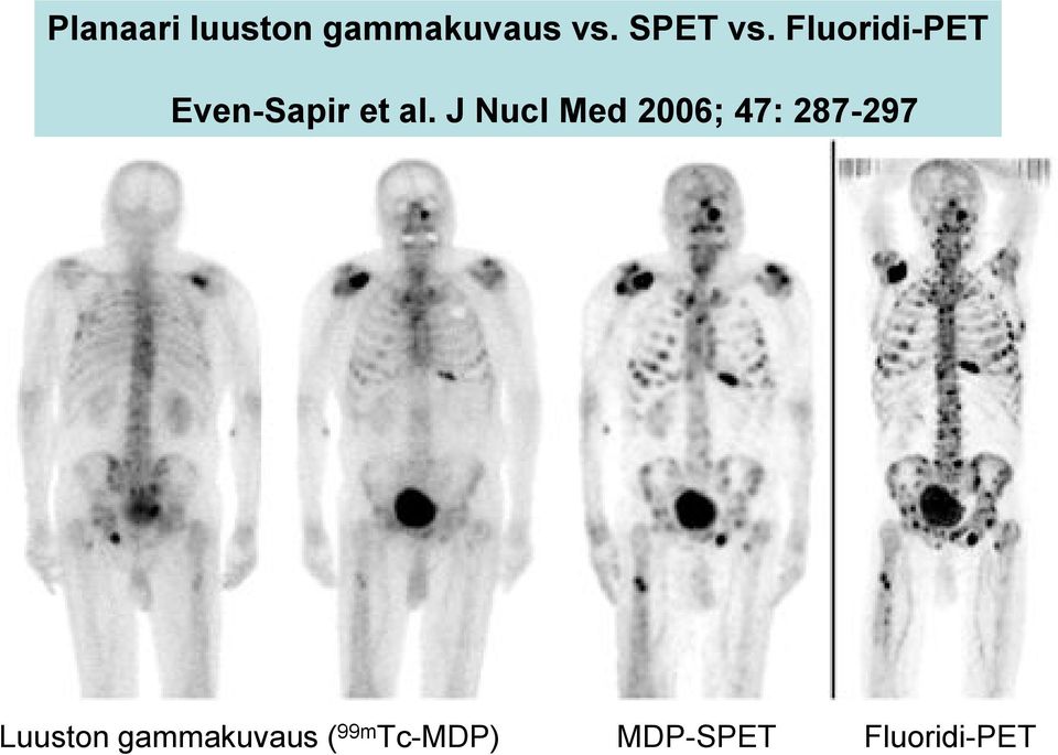 J Nucl Med 2006; 47: 287-297 Luuston