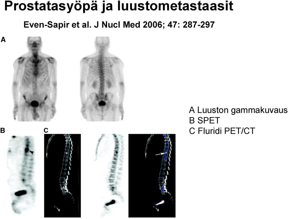 al. J Nucl Med 2006; 47: