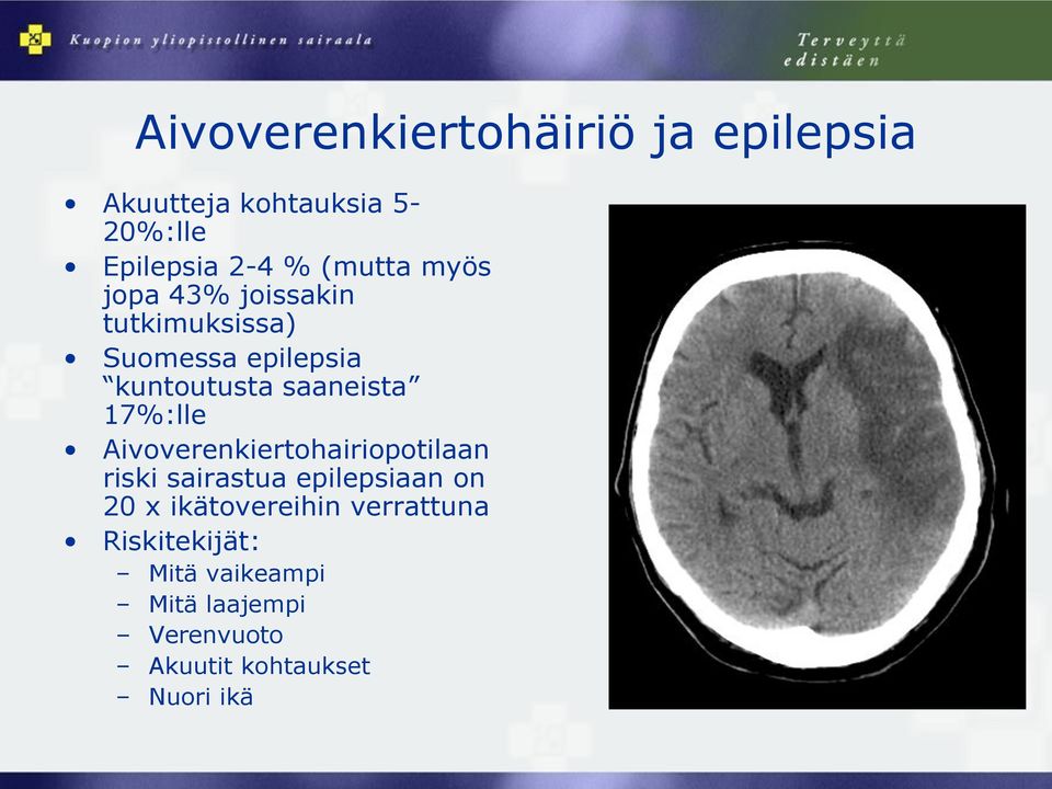 17%:lle Aivoverenkiertohairiopotilaan riski sairastua epilepsiaan on 20 x ikätovereihin