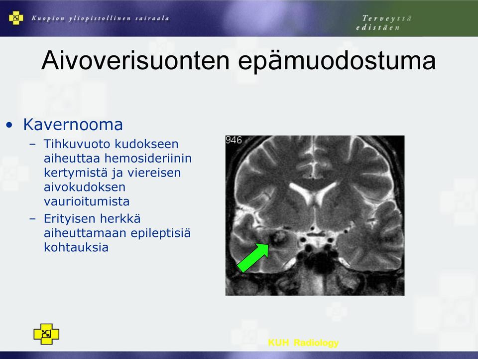 viereisen aivokudoksen vaurioitumista Erityisen