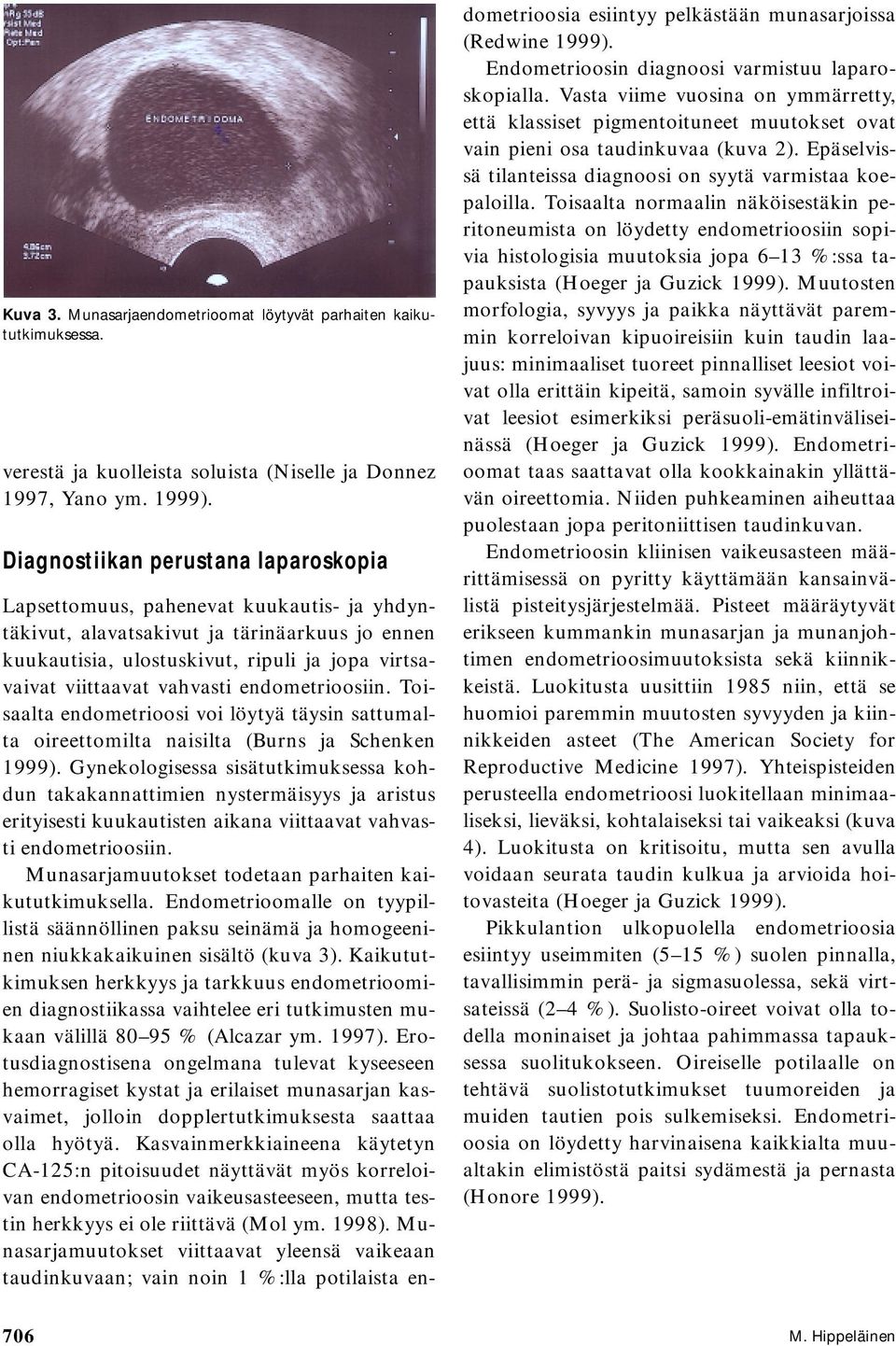 vahvasti endometrioosiin. Toisaalta endometrioosi voi löytyä täysin sattumalta oireettomilta naisilta (Burns ja Schenken 1999).