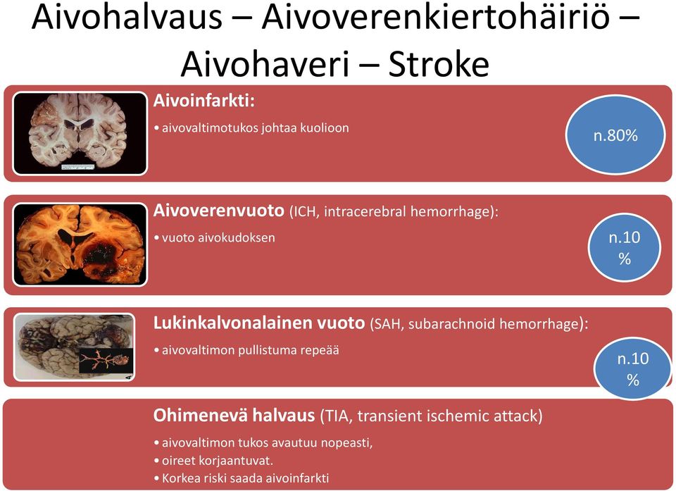 10 % Lukinkalvonalainen vuoto (SAH, subarachnoid hemorrhage): aivovaltimon pullistuma repeää n.