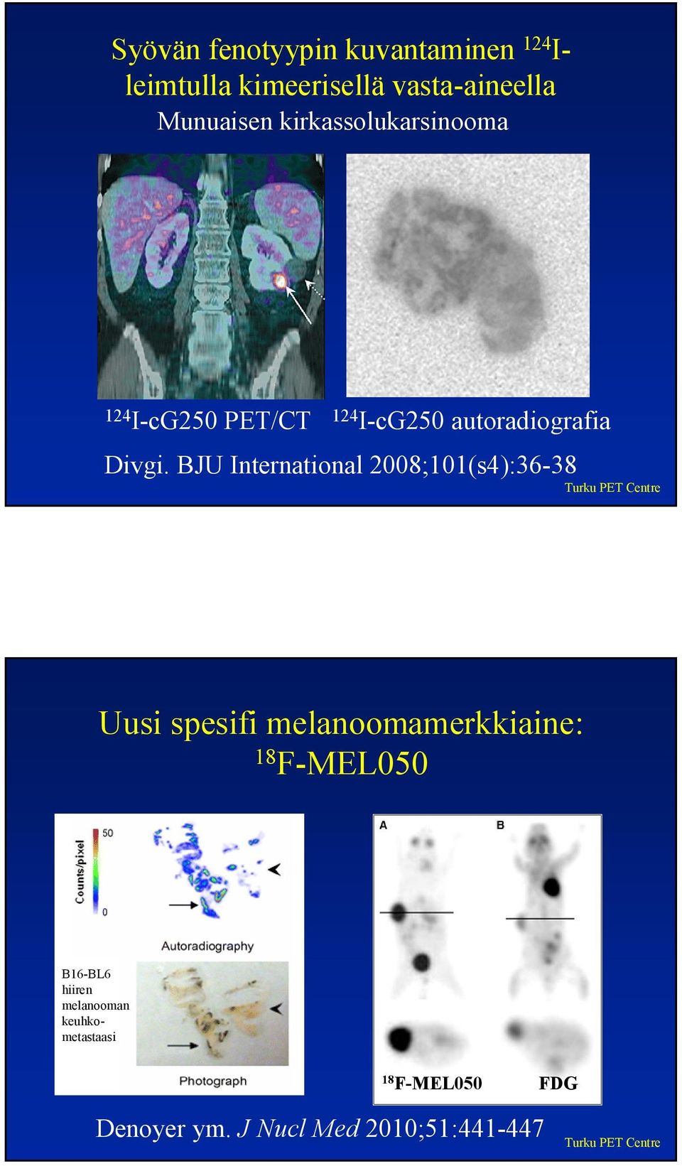 BJU International 2008;101(s4):36-38 Uusi spesifi melanoomamerkkiaine: 18 F-MEL050