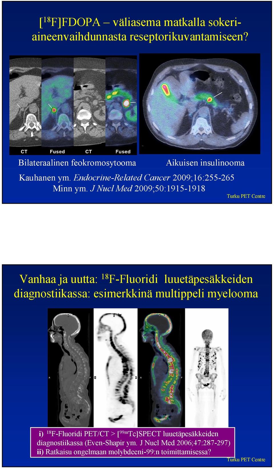 J Nucl Med 2009;50:1915-1918 Vanhaa ja uutta: 18 F-Fluoridi luuetäpesäkkeiden diagnostiikassa: esimerkkinä multippeli