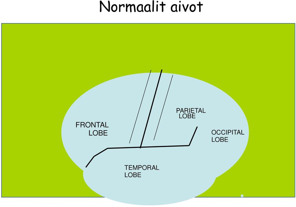 PARIETAL LOBE