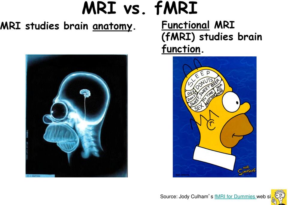 Functional MRI (fmri) studies