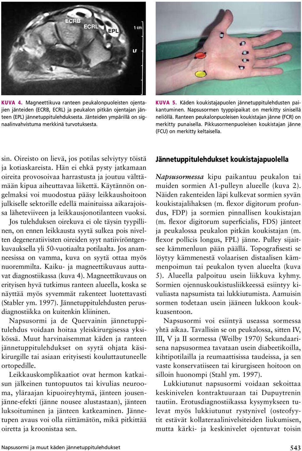 Ranteen peukalonpuoleisen koukistajan jänne (FCR) on merkitty punaisella. Pikkusormenpuoleisen koukistajan jänne (FCU) on merkitty keltaisella. sin.