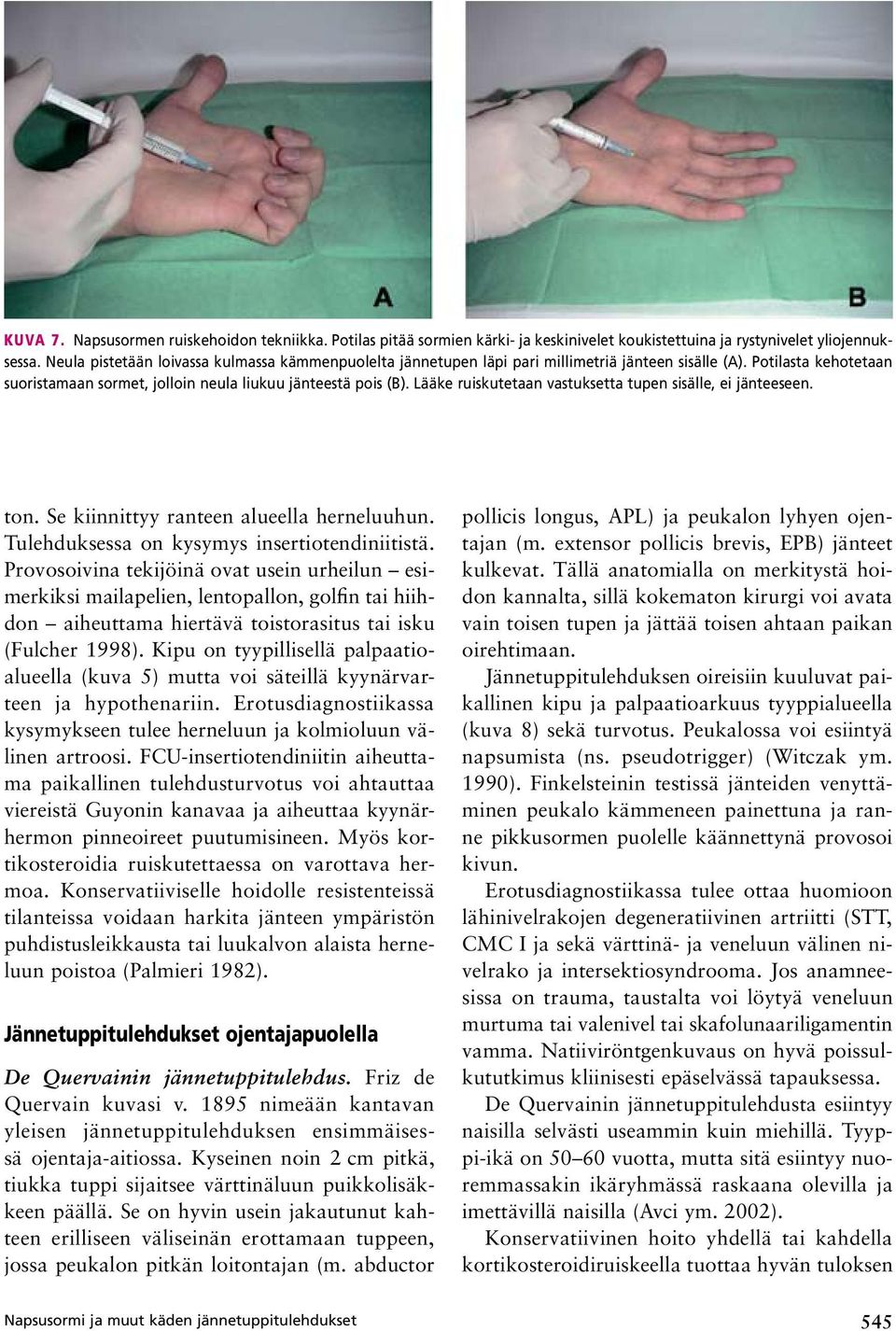 Lääke ruiskutetaan vastuksetta tupen sisälle, ei jänteeseen. ton. Se kiinnittyy ranteen alueella herneluuhun. Tulehduksessa on kysymys insertiotendiniitistä.