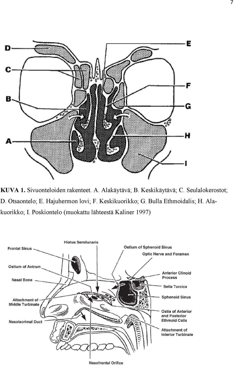 Hajuhermon lovi; F. Keskikuorikko; G.